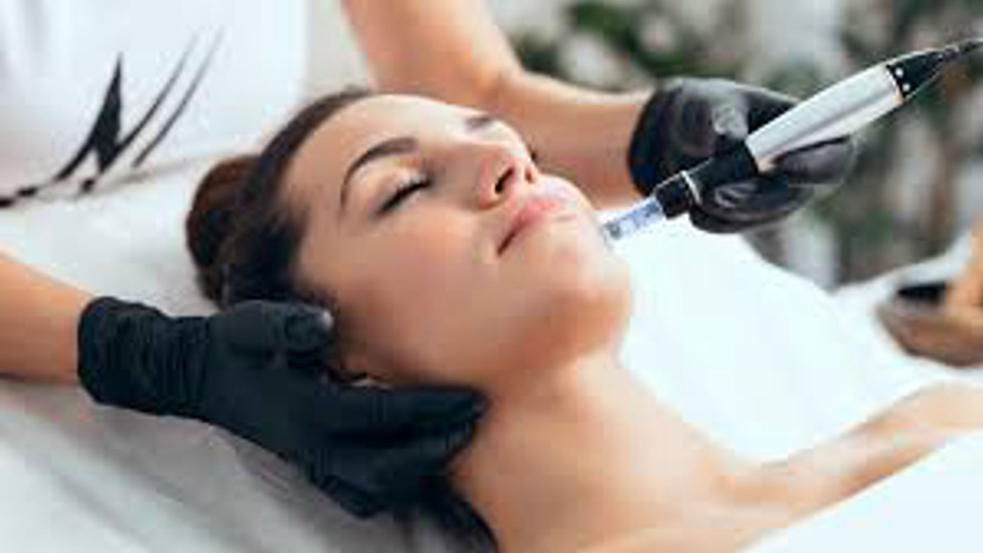 Microneedling