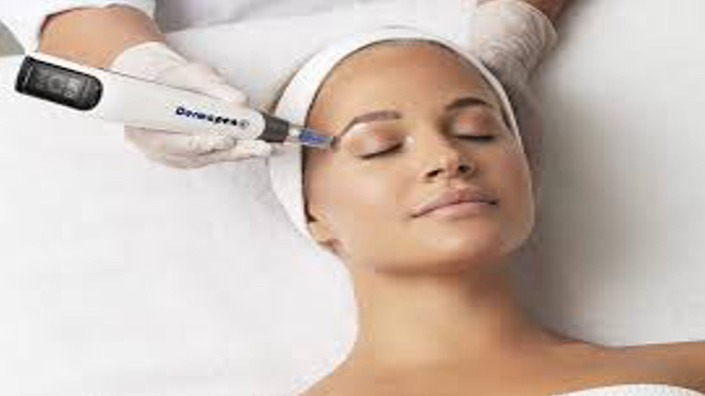 Microneedling Facial