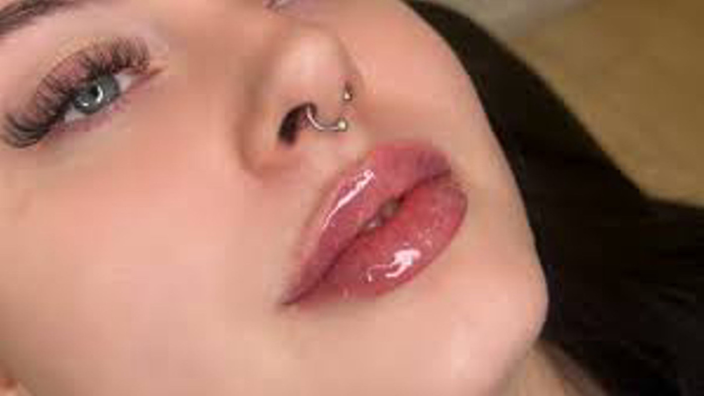Lip Filler 1.1ml