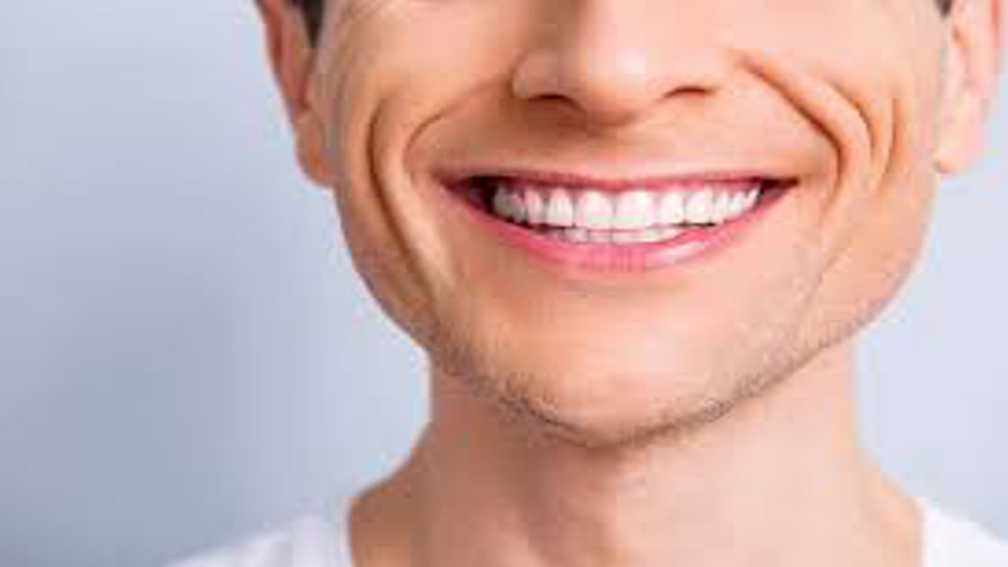 Smile Lines